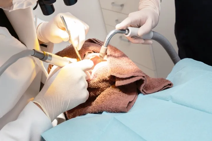 歯の根(神経)の治療